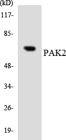 PAK2 Antibody - Western blot analysis of the lysates from HepG2 cells using PAK2 antibody.