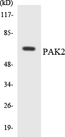 PAK2 Antibody - Western blot analysis of the lysates from COLO205 cells using PAK2 antibody.