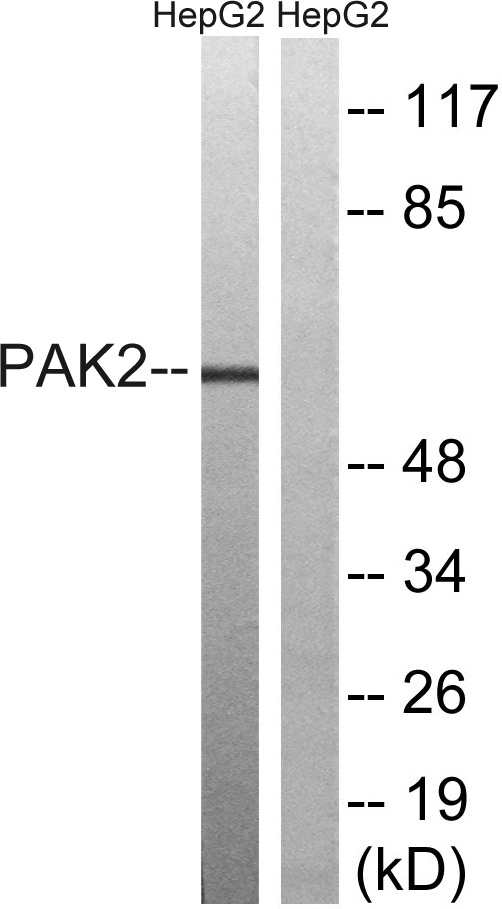 PAK2 Antibody - Western blot analysis of lysates from HepG2 cells, treated with serum 20% 15', using PAK2 Antibody. The lane on the right is blocked with the synthesized peptide.