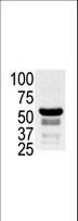 PAK2 Antibody - The anti-PAK2 antibody is used in Western blot to detect PAK2 in ovary cell lysate. Data is kindly provided by Elena Black from Boston University (Boston, MA).