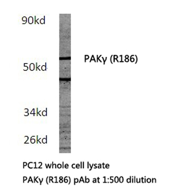 PAK2 Antibody - Western blot of PAK (R186) pAb in extracts from PC12 cells.