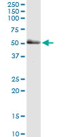 PAK2 Antibody - PAK2 monoclonal antibody (M01), clone 1E1. Western Blot analysis of PAK2 expression in human liver.