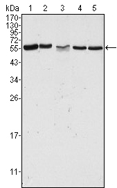 PAK2 Antibody - Western blot using PAK2 mouse monoclonal antibody against HeLa (1), Jurkat (2), A549 (3), HEK293 (4) and K562 (5) cell lysate.