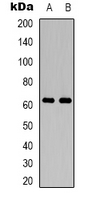PAK2 Antibody - Western blot analysis of PAK2 expression in HepG2 (A); PC12 (B) whole cell lysates.