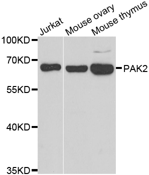 PAK2 Antibody - Western blot analysis of extracts of various cell lines.