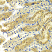 PAK2 Antibody - Immunohistochemistry of paraffin-embedded mouse kidney tissue.