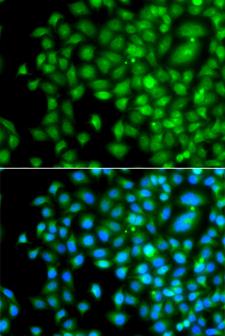 PAK2 Antibody - Immunofluorescence analysis of A549 cells.