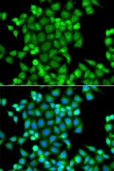 PAK2 Antibody - Immunofluorescence analysis of A549 cells.