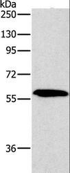 PAK2 Antibody - Western blot analysis of A172 cell, using PAK2 Polyclonal Antibody at dilution of 1:400.
