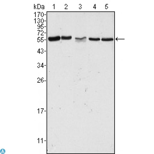 PAK2 Antibody - Western Blot (WB) analysis using PAKgamma Monoclonal Antibody against HeLa (1), Jurkat (2), A549 (3), HEK293 (4) and K562 (5) cell lysate.