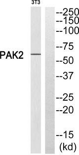 PAK2 Antibody - Western blot analysis of extracts from 3T3 cells, using PAK2 (Ab-20) antibody.