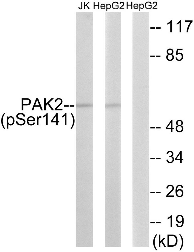 PAK2 Antibody - Western blot analysis of lysates from HepG2 cells treated with Adriamycin 0.5uM 24h/Jurkat cells treated with PMA 125ng/ml 30', using PAK2 (Phospho-Ser141) Antibody. The lane on the right is blocked with the phospho peptide.
