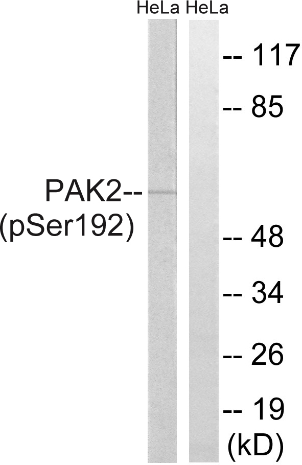 PAK2 Antibody - Western blot analysis of lysates from HeLa cells, using PAK2 (Phospho-Ser192) Antibody. The lane on the right is blocked with the phospho peptide.