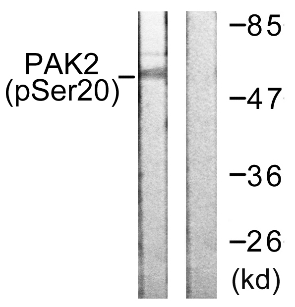 PAK2 Antibody - Western blot analysis of lysates from 293 cells treated with Sorbitol 0.4M 30', using PAK2 (Phospho-Ser20) Antibody. The lane on the right is blocked with the phospho peptide.