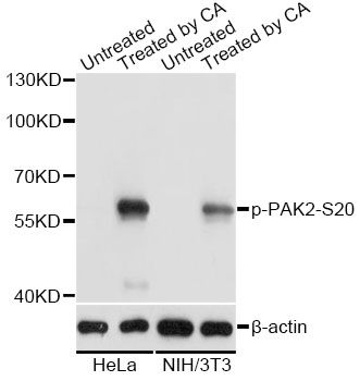 PAK2 Antibody - Western blot analysis of extracts of HeLa and NIH/3T3 cells, using Phospho-PAK2-S20 antibody at 1:2000 dilution. HeLa cells were treated by Calyculin A (100nM) for 30 minutes after serum-starvation overnight.NIH/3T3 cells were treated by Calyculin A (100nM) for 30 minutes after serum-starvation overnight. The secondary antibody used was an HRP Goat Anti-Rabbit IgG (H+L) at 1:10000 dilution. Lysates were loaded 25ug per lane and 3% nonfat dry milk in TBST was used for blocking. Blocking buffer: 3% BSA.An ECL Kit was used for detection and the exposure time was 5s.