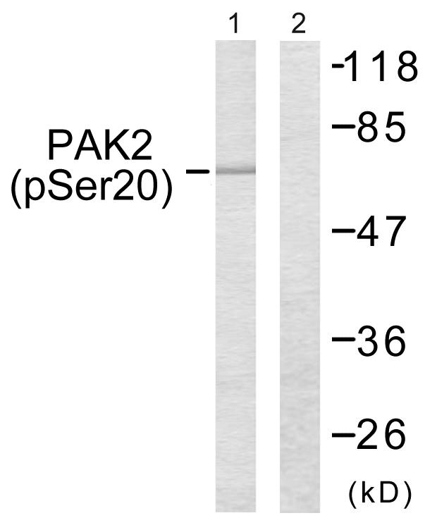 PAK2 Antibody - Western blot analysis of extracts from 293 cells, treated with Sorbitol (0.4M, 30mins), using PAK2 (Phospho-Ser20) antibody.