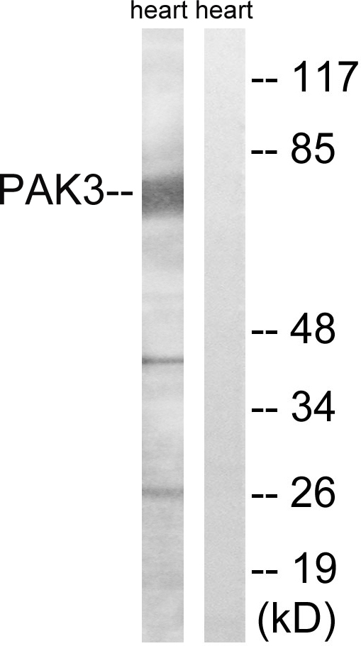 PAK3 Antibody - Western blot analysis of lysates from rat heart cells, using PAK3 Antibody. The lane on the right is blocked with the synthesized peptide.