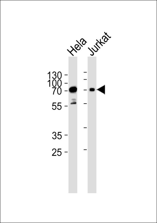 PAK3 Antibody - Western blot of lysates from HeLa, Jurkat cell line (from left to right), using Mouse Pak3 Antibody. Antibody was diluted at 1:1000 at each lane. A goat anti-rabbit IgG H&L (HRP) at 1:5000 dilution was used as the secondary antibody. Lysates at 35ug per lane.