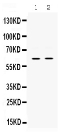 PAK3 Antibody - Western blot analysis of PAK3 expression in rat brain extract (lane 1) and mouse brain extract (lane 2). PAK3 at 62KD was detected using rabbit anti-PAK3 Antigen Affinity purified polyclonal antibody at0.5 ug/ml. The blot was developed using chemiluminescence (ECL) method.