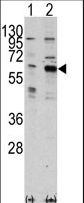 PAK3 Antibody - Western blot of PAK3(arrow) using rabbit polyclonal PAK3 Antibody. 293 cell lysates (2 ug/lane) either nontransfected (Lane 1) or transiently transfected with the PAK3 gene (Lane 2) (Origene Technologies).