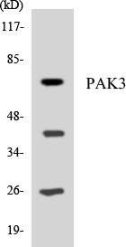 PAK3 Antibody - Western blot analysis of the lysates from HeLa cells using PAK3 antibody.