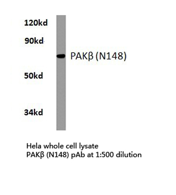 PAK3 Antibody - Western blot of PAK (N148) pAb in extracts from HeLa cells.