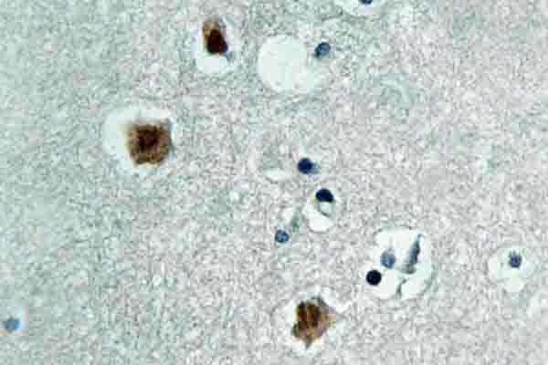 PAK3 Antibody - IHC of PAK (N148) pAb in paraffin-embedded human brain tissue.