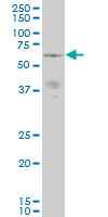PAK3 Antibody - PAK3 monoclonal antibody (M07), clone 1H7 Western Blot analysis of PAK3 expression in NIH/3T3.
