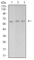 PAK3 Antibody - Western blot analysis using PAK3 mouse mAb against Hela (1), SK-N-SH (2), and T47D (3) cell lysate.