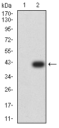 PAK3 Antibody - Western blot analysis using PAK3 mAb against HEK293 (1) and PAK3 (AA: 1-100)-hIgGFc transfected HEK293 (2) cell lysate.