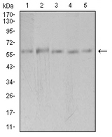 PAK3 Antibody - Western blot analysis using PAK3 mouse mAb against Hela (1), SK-N-SH (2), T47D (3), COS7 (4), and HepG2 (5) cell lysate.