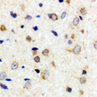 PAK3 Antibody - Immunohistochemical analysis of PAK3 staining in human brain formalin fixed paraffin embedded tissue section. The section was pre-treated using heat mediated antigen retrieval with sodium citrate buffer (pH 6.0). The section was then incubated with the antibody at room temperature and detected using an HRP conjugated compact polymer system. DAB was used as the chromogen. The section was then counterstained with hematoxylin and mounted with DPX.