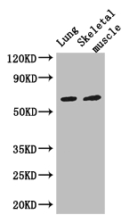 PAK3 Antibody - Positive WB detected in:Mouse lung tissue,Mouse skeletal muscle tissue;All lanes: PAK3 antibody at 3ug/ml;Secondary;Goat polyclonal to rabbit IgG at 1/50000 dilution;Predicted band size: 63,61,65 kDa;Observed band size: 63 kDa;