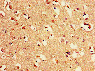 PAK3 Antibody - Immunohistochemistry of paraffin-embedded human brain tissue using PAK3 Antibody at dilution of 1:100