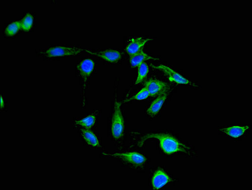 PAK3 Antibody - Immunofluorescent analysis of Hela cells using PAK3 Antibody at a dilution of 1:100 and Alexa Fluor 488-congugated AffiniPure Goat Anti-Rabbit IgG(H+L)