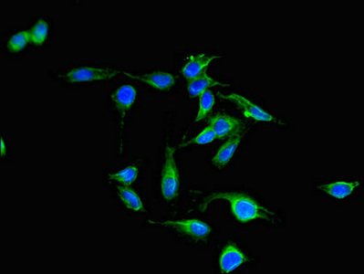 PAK3 Antibody - Immunofluorescent analysis of Hela cells using PAK3 Antibody at dilution of 1:100 and Alexa Fluor 488-congugated AffiniPure Goat Anti-Rabbit IgG(H+L)