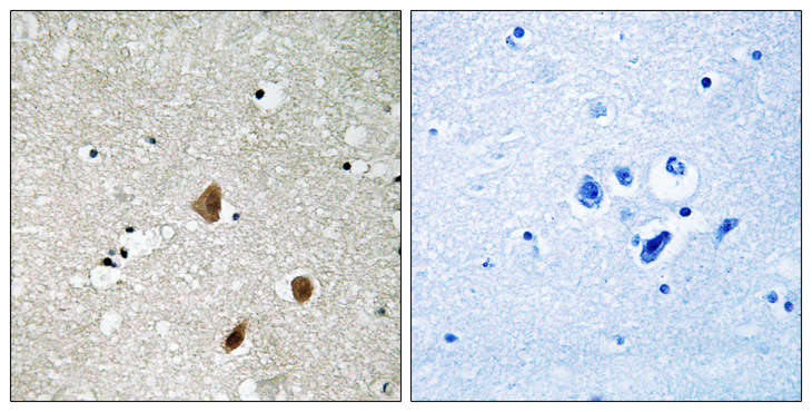 PAK3 Antibody - Immunohistochemistry analysis of paraffin-embedded human brain, using PAK3 (Phospho-Ser154) Antibody. The picture on the right is blocked with the phospho peptide.