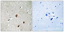 PAK3 Antibody - Immunohistochemistry analysis of paraffin-embedded human brain, using PAK3 (Phospho-Ser154) Antibody. The picture on the right is blocked with the phospho peptide.