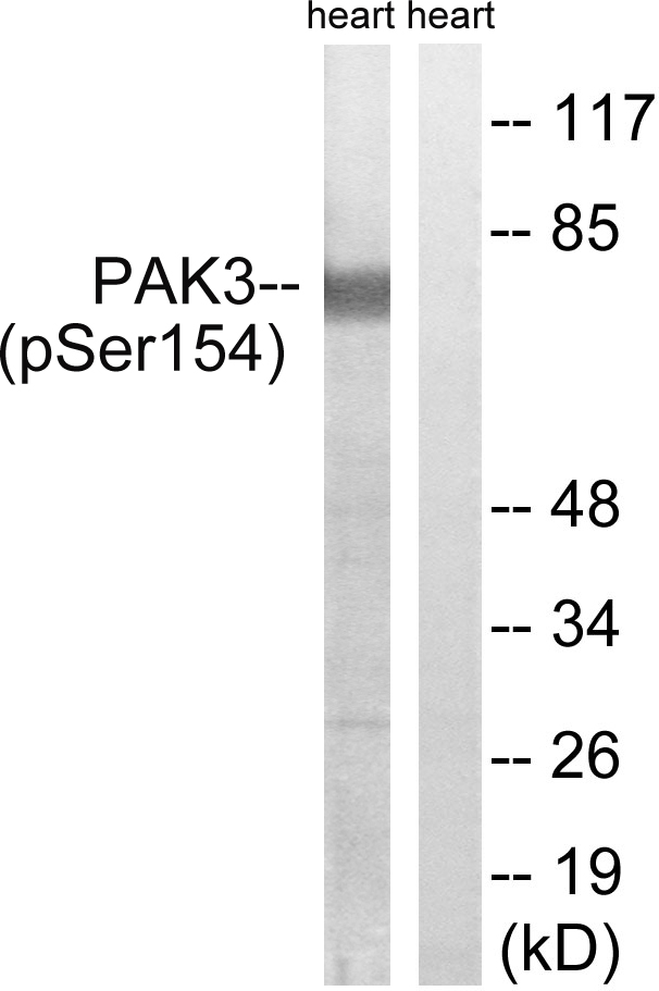 PAK3 Antibody - Western blot analysis of lysates from rat heart, using PAK3 (Phospho-Ser154) Antibody. The lane on the right is blocked with the phospho peptide.