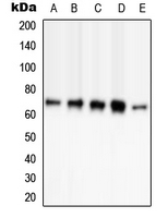 PAK3 Antibody - Western blot analysis of PAK3 (pS154) expression in HEK293T EGF-treated (A); NIH3T3 (B); mouse brain (C); SP2/0 EGF-treated (D); H9C2 EGF-treated (E) whole cell lysates.