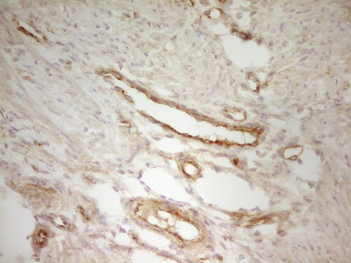 PAK4 Antibody - Immunohistochemical staining of paraffin-embedded Human endometrium tissue within the normal limits using anti-PAK4 mouse monoclonal antibody. (Heat-induced epitope retrieval by 1 mM EDTA in 10mM Tris, pH8.5, 120C for 3min,