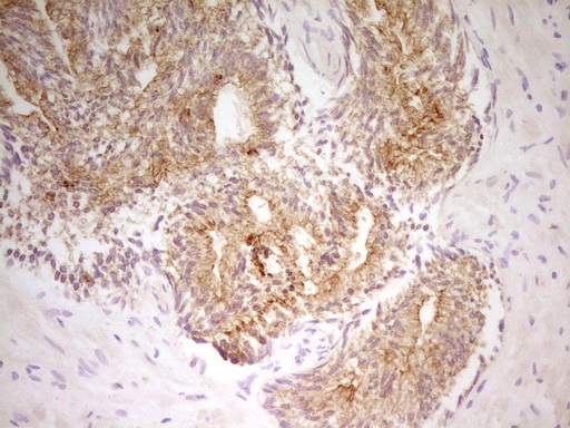 PAK4 Antibody - Immunohistochemical staining of paraffin-embedded Human prostate tissue within the normal limits using anti-PAK4 mouse monoclonal antibody. (Heat-induced epitope retrieval by 1 mM EDTA in 10mM Tris, pH8.5, 120C for 3min,