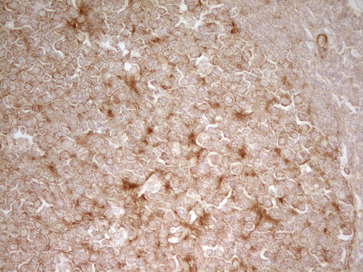 PAK4 Antibody - Immunohistochemical staining of paraffin-embedded Human tonsil within the normal limits using anti-PAK4 mouse monoclonal antibody. (Heat-induced epitope retrieval by 1 mM EDTA in 10mM Tris, pH8.5, 120C for 3min,