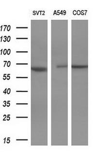 PAK4 Antibody - Western blot analysis of extracts. (10ug) from 3 different cell lines by using anti-PAK4 monoclonal antibody. (1:1000)