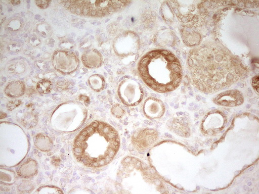 PAK4 Antibody - Immunohistochemical staining of paraffin-embedded Human Kidney tissue within the normal limits using anti-PAK4 mouse monoclonal antibody. (Heat-induced epitope retrieval by 1 mM EDTA in 10mM Tris, pH8.5, 120C for 3min,