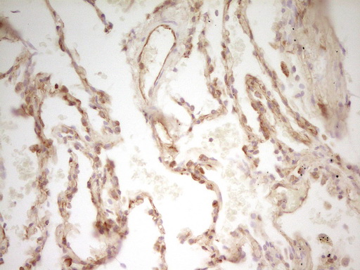 PAK4 Antibody - Immunohistochemical staining of paraffin-embedded Human lung tissue within the normal limits using anti-PAK4 mouse monoclonal antibody. (Heat-induced epitope retrieval by 1 mM EDTA in 10mM Tris, pH8.5, 120C for 3min,