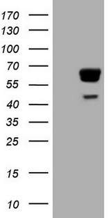PAK4 Antibody - HEK293T cells were transfected with the pCMV6-ENTRY control (Left lane) or pCMV6-ENTRY PAK4 (Right lane) cDNA for 48 hrs and lysed. Equivalent amounts of cell lysates (5 ug per lane) were separated by SDS-PAGE and immunoblotted with anti-PAK4.