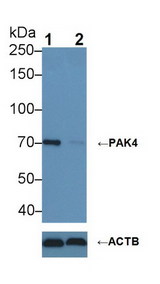 PAK4 Antibody - Knockout Varification: Lane 1: Wild-type Hela cell lysate; Lane 2: PAK4 knockout Hela cell lysate; Predicted MW: 64kDa Observed MW: 70kDa Primary Ab: 1µg/ml Rabbit Anti-Human PAK4 Antibody Second Ab: 0.2µg/mL HRP-Linked Caprine Anti-Rabbit IgG Polyclonal Antibody