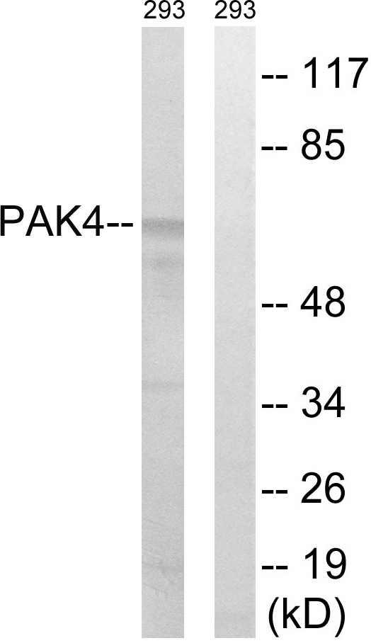 PAK4 Antibody - Western blot analysis of lysates from K562 cells, treated with PMA 125ng/ml 30', using PAK4/5/6 Antibody. The lane on the right is blocked with the synthesized peptide.