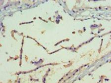 PAK4 Antibody - Immunohistochemistry of paraffin-embedded human prostate using antibody at 1:100 dilution.  This image was taken for the unconjugated form of this product. Other forms have not been tested.